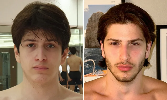 Looksmaxing – dlaczego to najlepsza inwestycja na 2026